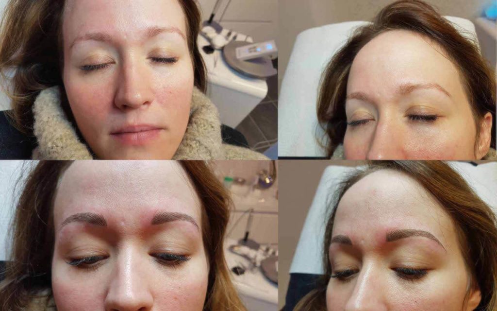 Der Prozess beim Permanent Make-up an den Augenbrauen.